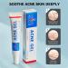 Anti Acne Face Cream Ance Gel Nourishing Formula - Buy Online on GoSupps.com