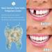 50PCS Temporary Tooth Crown Kit for Front Teeth - Denture Repair & False Tooth Replacement - Buy Online on GoSupps.com