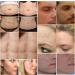 Aliver Scar Removal Cream - Stretch Mark & Acne Remover for Men & Women - Effective Treatment for Old & New Scars, Cuts, and Keloids - Buy Online on GoSupps.com