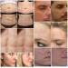 Scar Removal Cream for Old Scars, Stretch Marks & Burns - Natural Skin Repair for Acne Scars & Spots - Buy Online on GoSupps.com