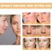 Glycolic Acid 7% Toning Solution for Face - Resurfacing and Peeling Serum - Buy Online on GoSupps.com