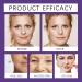 Tranexamic Acid Serum Tranexamic Acid Face Serum Brightening Serum for Face Dark Spot Remover for Face Txa Dark Spot Correcting Serum Reduces Hyperpigmentation Anti Wrinkle Hydrating - Buy Online on GoSupps.com