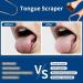 Stainless Steel Tongue Scraper Set - Rose Gold | Reduce Bad Breath, Maintain Oral Hygiene for Adults & Kids - Buy Online on GoSupps.com