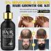 Men's Hair Growth Serum with Biotin - 60ML | Hair Care for Healthy & Thicker Hair Growth | Minoxidil for Men & Women | Hair Regrowth Treatment with 0.25mm Roller - Buy Online on GoSupps.com