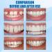 Xirujnfd Tooth Repair Granules - Cavity Filler Kit for Chipped Teeth & Temporary Fillings (1PCS) | Moldable False Teeth Solution - Buy Online on GoSupps.com
