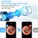 AWELOR Ear Wax Removal Camera - 1296P HD Endoscope Ear Cleaner for iPhone, iPad & Android - Wireless Otoscope with 6 LED Lights - Buy Online on GoSupps.com