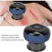 Electric Cupping Massager - 6-Speed Gua Sha Spa Scraper with Hot Compress | Intelligent Suction Cup for Back Neck Arm & Leg (Blue) - International Shipping Available - Buy Online on GoSupps.com