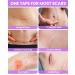 Silicone Scar Sheets - Medical Grade 1.6 x 120 Roll for Surgical Scars Keloids & C-Section Recovery - Non-Irritating Scar Removal Strips - Buy Online on GoSupps.com
