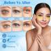 24K Gold Under Eye Patches- Hydrating, Nourishing, and Firming Eye Masks - 60 PCS, Reduce Puffiness, Dark Circles, and Wrinkles - Anti-Aging Collagen and Hyaluronic Acid Formula - Buy Online on GoSupps.com