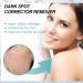 Dark Spot Corrector for Face - 3 Pack Freckle and Discoloration Correcting Serum - Buy Online on GoSupps.com
