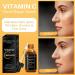 Derma Roller Kit for Face and Body - Vitamin C 20% Serum Skin Care Kit 540 Microneedling Face Roller 0.5mm Vitamin C E Hyaluronic Acid Serum Microneedle Roller Set for Acne Scar Anti Aging Wrinkles 2 Piece Set - Buy Online on GoSupps.com