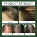 Batana Oil for Hair Growth Natural Batana Oil for Healthier Thicker Fuller Hair Promote Hair Regrowth Organic Batana Oil for Men & Women Leaves Your Hair Smoother Oil - Buy Online on GoSupps.com