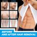 Pain-Free Hair Removal Cream for Men | Flawless Depilation in Genital Armpit & Bikini Areas - 1PC - Buy Online on GoSupps.com
