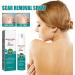 Medical Grade Scar Spray Effective Scar Removal for Surgical Scars & Stretch Marks | All Skin Types - Buy Online on GoSupps.com