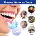 Shop Lagunamoon Teeth Whitening Kit - Gel & LED Light for a Bright Smile | International Shipping Available - Buy Online on GoSupps.com