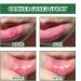 Spray de Soulagement Ulc res Buccaux Spray de Soulagement Ulc res Spray Ulc res de la Bouche 20ML Aphtes Buccaux Gonflement des Gencives Rafra chissant Soins Aphrodisiaques - Buy Online on GoSupps.com