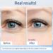 Anti-Aging Eye Cream with Caffeine & Peptide Complex | Moisturizing Serum for Dark Circles & Puffiness - Lavender Scent 20ml - Buy Online on GoSupps.com