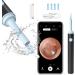 Wifi Intelligent Visual Earpick Mini Camera Endoscope - Ear Cleaning Tool for All Smartphones (Black - Buy Online on GoSupps.com