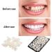 70PCS Temporary Tooth Crown Repair Kit - Durable Fake Teeth Cap for Missing or Broken Front Tooth - Oral Care Dental Repair Solution - Buy Online on GoSupps.com