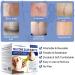 Transparent Silicone Plaster for Scars | C-Section Burns Keloids & Acne - Medication-Free Solution (4cm x 300cm Roll) - Buy Online on GoSupps.com