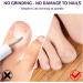 Grgowe Nail Correction Ingrown Toenail Corrector Foot Toenail Plasters Foot Correction Foot Toenail Correction for Care of Toenail Treatment Protect - Buy Online on GoSupps.com