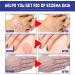 DermaCure Herbal Psoriasis Relief Treatment Spray for Skin Plaque Psoriasis - Buy Online on GoSupps.com