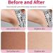 Ninnyi Armpit Cream for Thigh Knees Elbows Leg - Buy Online on GoSupps.com