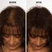 Infinity Hair Fiber - Hair Loss Concealer for Men & Women - Dark Brown 30g - Buy Online on GoSupps.com