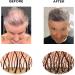 Coloured Hair Thickening Fibres by Keratech Pro 12ml | Instantly Fuller and Thicker hair | Advanced 100% Natural Keratin formula | Light Blonde - Buy Online on GoSupps.com
