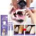 Pet Oral Repair Gel Pet Oral Repair Gel for Fast Healing - Easy-Apply Gel Pen for Daily Maintenance Ideal for Sensitive Gums & Dental Hygiene - Suitable for All Dog Breeds(2pcs) - Buy Online on GoSupps.com