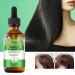 Shenrongtong Rosemary Oil for Hair Growth - Pure Essential 2.11 fl oz Bio-Rosmarin Oil Nourishes Scalp & Stimulates Hair Growth - Buy Online on GoSupps.com