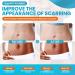 WONDERSCAR 10 Large Silicone Scar Sheets - Medical Grade Treatment for Keloid, C-Section, Burn, Stretch Marks & Acne - Reusable Gel Strips for Scar Removal - Buy Online on GoSupps.com