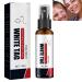 KOAHDE Psoriasis Treatment Spray Vitiligo Relief Spray Psoriasis Control Face and Body Cream Soothing and Moisturizing Coal Tar Psoriasis Cream Spray Psoriasis Control White Spot Spray 30ml 1PC