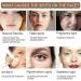 Tranexamic Acid Serum Tranexamic Acid Skin Brightening Serum Dark Spot Correcting Glow Serum Moisturiser For Acne Prone Skin with Hyaluronic Acid Arbutin Hyperpigmentation and Even Skin Tone - Buy Online on GoSupps.com