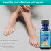 Toenail Fungus Treatment - Nail Fungus Treatment for Toenail - Anti Fungal Nail Treatment for Thickening Yellow - Brown Discoloration - Fast Extra Strong Nail Repair Solution - Buy Online on GoSupps.com