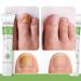 Floepx Nail Repair Gel - 2 PCs Nail Care Treatment for Cracked Rough Nails & Discoloration - Protect & Repair Your Toenails - Buy Online on GoSupps.com
