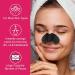AGETITY Nose Strips 90 Pcs - Blackhead Remover for Women - Deep Cleansing Pore Strips - Buy Online on GoSupps.com