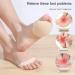 SooGree Ball of Foot Cushions for Women | Honeycomb Metatarsal Foot Pads for Pain Relief | Best Shoe Inserts & Foot Petals - Buy Online on GoSupps.com