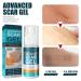 Scar Removal Cream 2pcs - Mild Gel for Old & New Scars, Stretch Marks, Wrinkles - 50ml - Buy Online on GoSupps.com