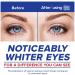 Clear Eyes Redness Relief Eye Drops - 0.5 fl oz | Soothes & Reduces Redness - Buy Online on GoSupps.com