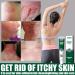 Antifungal Cream:Jock Itch Cream Soothing Eczema Relief Cream All-Natural Soothing Care & Fast Relief of Jock Itch Eczema Psoriasis - Ringworm Treatment for Humans - for Adults and Kids - Buy Online on GoSupps.com