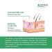 Alhydran SPF 30 | Advanced Skin Repair with added UV Protection | Cream for Damaged Skin Burn Scar Eczema Skin Reaction | 59ml - Buy Online on GoSupps.com