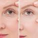 Expression Line Smoothing Forehead Patch | Medical-Grade Silicone for Anti-Aging & Overnight Wrinkle Reduction | 20X Reusable Beautify Brow Lift - Buy Online on GoSupps.com