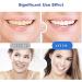 iTauyees Teeth Whitening Strips - Effective Teeth Bleaching for White Teeth & Smoke Stain Removal | 14 Strips International Shipping - Buy Online on GoSupps.com