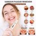 CuteLove Dental Tools Set - 3 Modes, 4 Heads, LED Light, Rechargeable - Tartar Remover, Oral Mirror, Dental Pick, Tongue Scraper - White - Buy Online on GoSupps.com