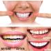 New Propolis Teeth Regrow Dental Gel & Whitening Pen Set | Effective Teeth Bleaching & Stain Removal - Buy Online on GoSupps.com