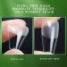 FEIlei Long Coffin Fakes Nail Tips Acrylic Press on Nails Clear Artificial False Nails - Buy Online on GoSupps.com