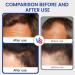 3pcs S rum pour la croissance des cheveux Micro Infuse Cheveux Repousse cheveux Hair Regrowth System Acc l re La Pousse Des Cheveux Les Fortifie et Nourrit Les Racines - Buy Online on GoSupps.com