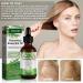 Cyxel Rosemary Oil - Boost Hair Growth Nourish Scalp & Soothing Skin Care for Aromatherapy Massage & Diffusers - Buy Online on GoSupps.com