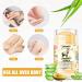 Lot de 2 Cr mes Mains et Pieds Anti-fissures - Lait de Ch vre et Parfum Lavande - Baume Talon Hydratant 60% D'ur e - R paration Intensive des Peaux S ches et Craquel es pour Femmes et Hommes - Buy Online on GoSupps.com